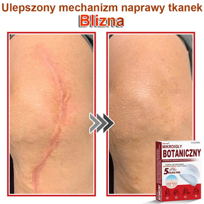 Dorina® Mikroigłowy botaniczny środek do usuwania narośli skórnych ✅✅✅wyprodukowano w Polsce
