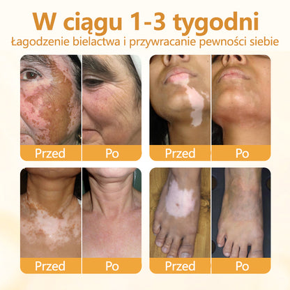 Dorina® VitiCalm krem z jadem pszczelim🌻🌻🌻