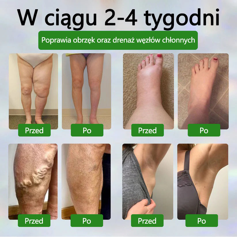 🔥Dorina® Krem ziołowy łagodzący obrzęki z czarnuszką