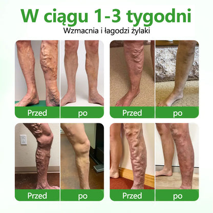 🌿🌿Dorina® Plaster z mikroigłami VeinHeal