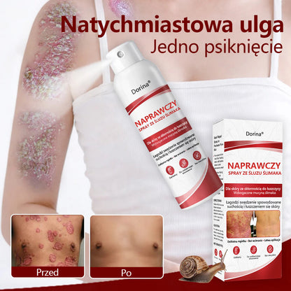 🔥Spray regenerujący Dorina® jest przeznaczony do stosowania w przypadku swędzenia i łuszczenia się skóry wywołanych łuszczycą.