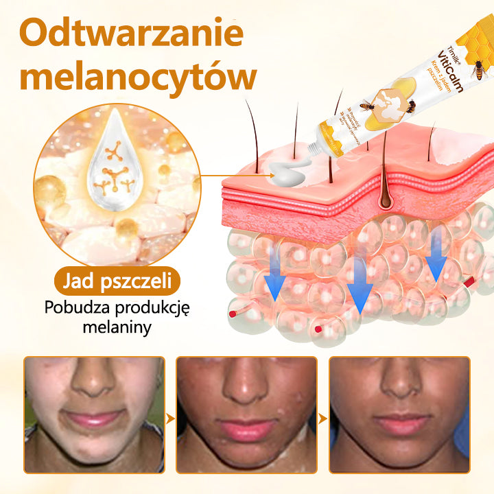 Dorina® VitiCalm krem z jadem pszczelim🌻🌻🌻