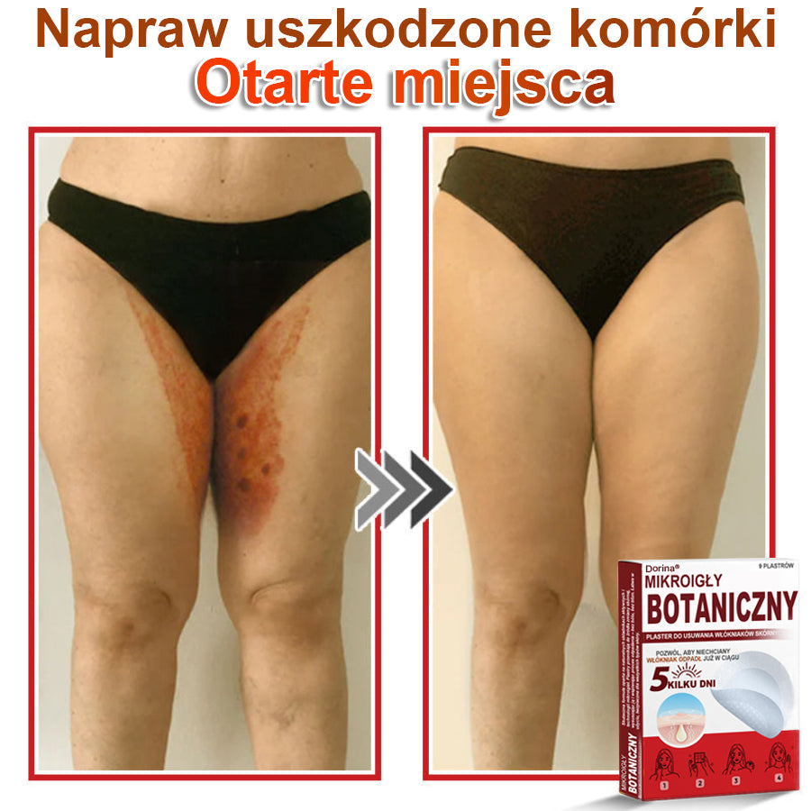 Dorina® Mikroigłowy botaniczny środek do usuwania narośli skórnych ✅✅✅wyprodukowano w Polsce