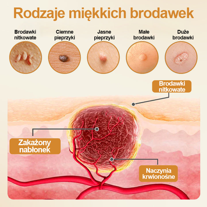 🔥Dorina® Spray na brodawki z jadem pszczelim