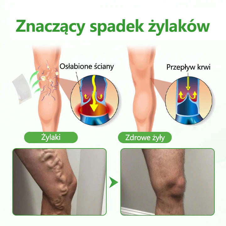 🌿🌿Dorina® Plaster z mikroigłami VeinHeal