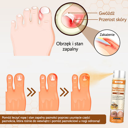 ✅Dorina® spray z jadem pszczelim nailrescue
