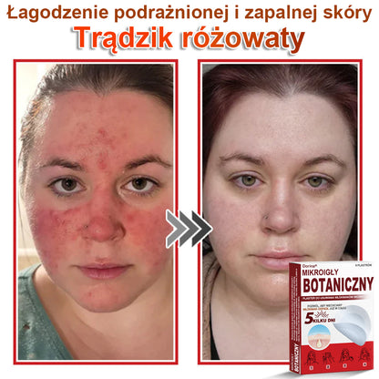 Dorina® Mikroigłowy botaniczny środek do usuwania narośli skórnych ✅✅✅wyprodukowano w Polsce