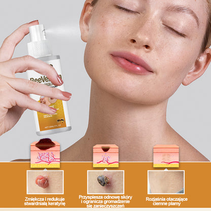 🔥Dorina® Spray na brodawki z jadem pszczelim