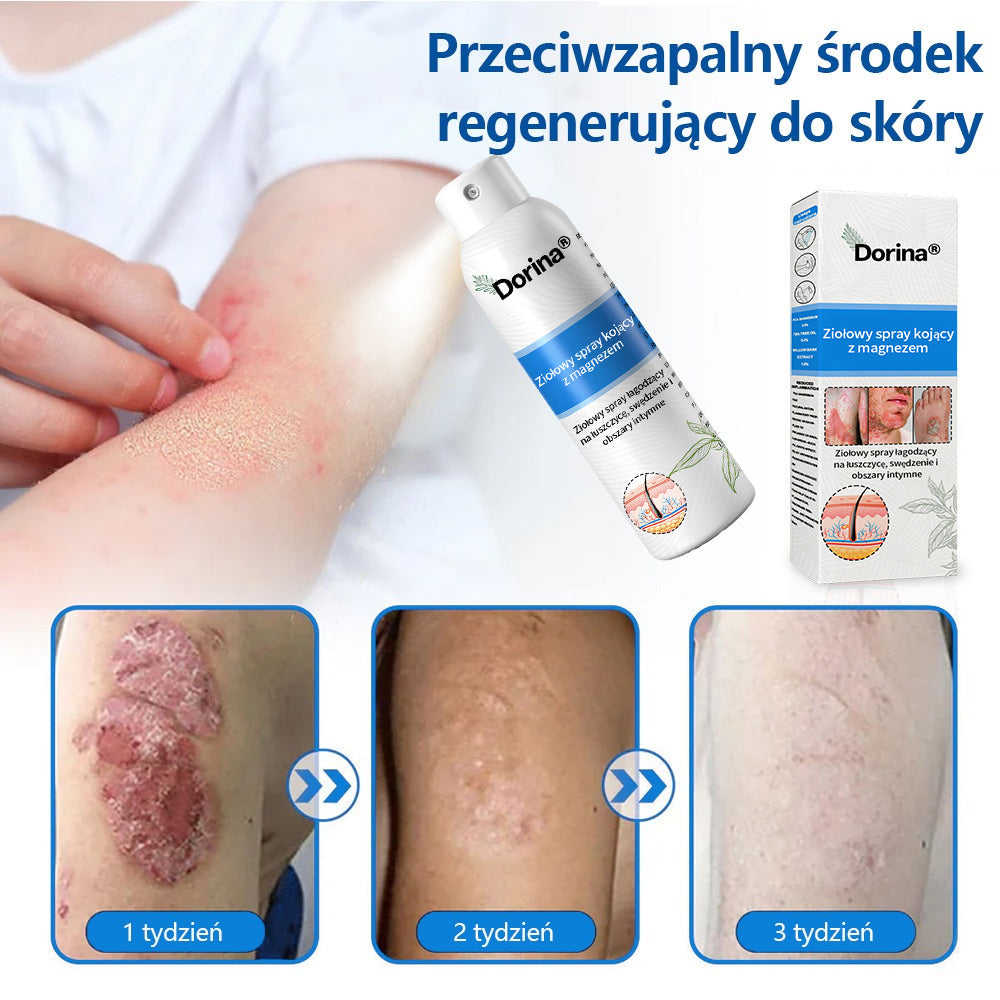 Oficjalny sklep✅: Dorina®Magnezowy spray ziołowy na łuszczycę✨