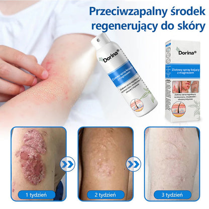 Oficjalny sklep✅: Dorina®Magnezowy spray ziołowy na łuszczycę✨