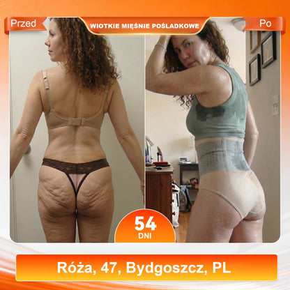 Dorina® 2026 Moringa i Berberyna 4-w-1 Spodenki Modelujące i Spalające Tłuszcz z Mikrocząsteczkami🛡️