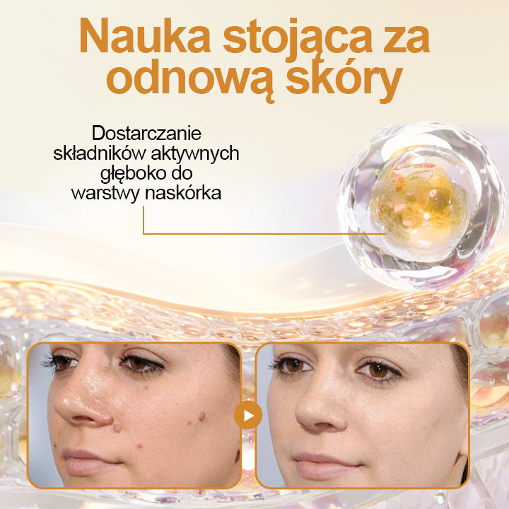 🔥Dorina® Spray na brodawki z jadem pszczelim