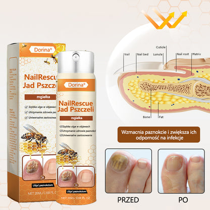 ✅Dorina® spray z jadem pszczelim nailrescue