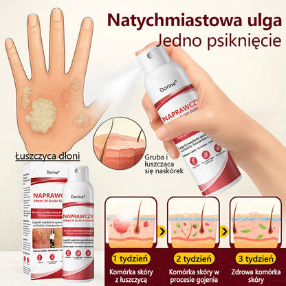 🔥Spray regenerujący Dorina® jest przeznaczony do stosowania w przypadku swędzenia i łuszczenia się skóry wywołanych łuszczycą.