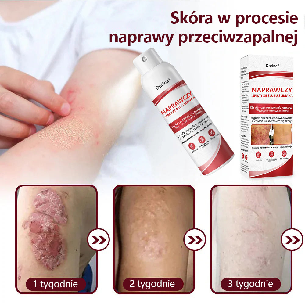 🔥Spray regenerujący Dorina® jest przeznaczony do stosowania w przypadku swędzenia i łuszczenia się skóry wywołanych łuszczycą.