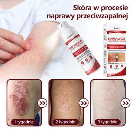🔥Spray regenerujący Dorina® jest przeznaczony do stosowania w przypadku swędzenia i łuszczenia się skóry wywołanych łuszczycą.