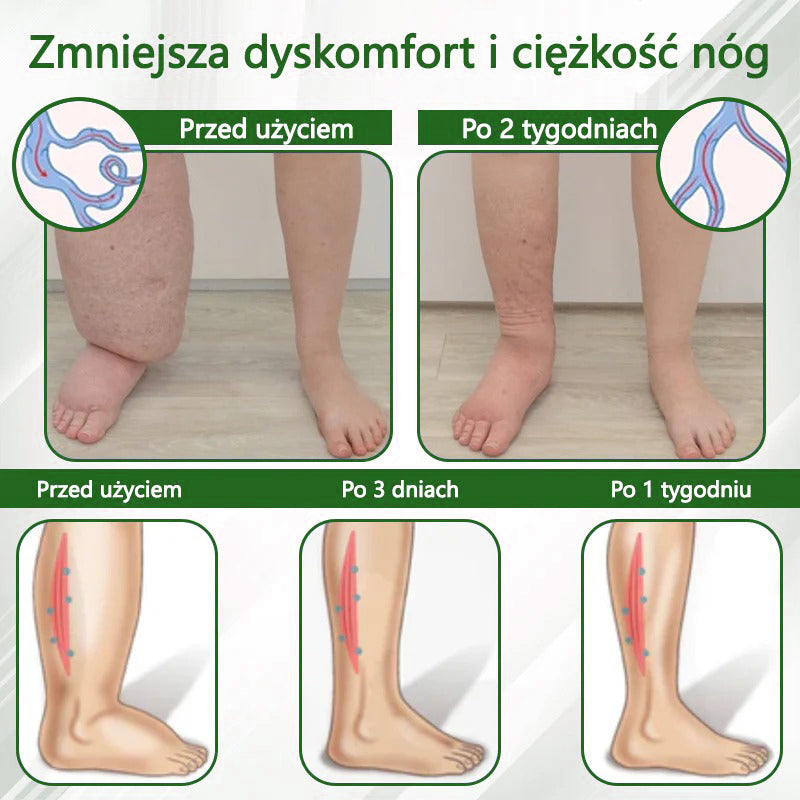 🔥Dorina® Krem ziołowy łagodzący obrzęki z czarnuszką