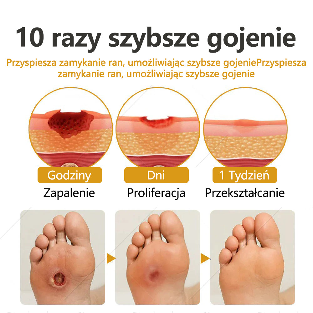 Dorina®GlucoShield – spray na rany z jadem pszczelim🔥