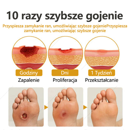 Dorina®GlucoShield – spray na rany z jadem pszczelim🔥