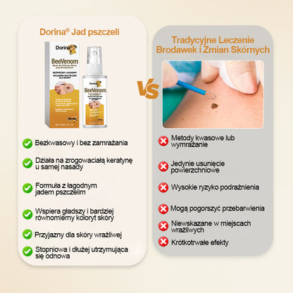 🔥Dorina® Spray na brodawki z jadem pszczelim