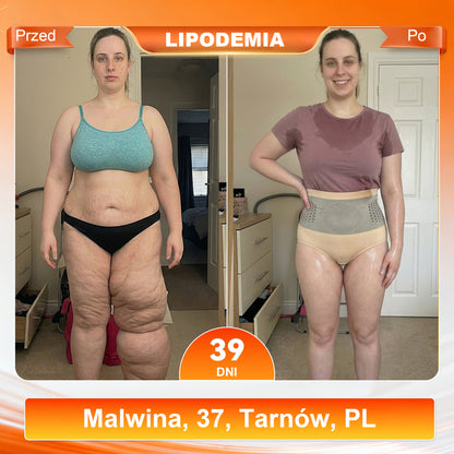 Dorina® 2026 Moringa i Berberyna 4-w-1 Spodenki Modelujące i Spalające Tłuszcz z Mikrocząsteczkami🛡️