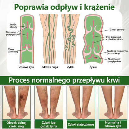 🔥Dorina® Krem ziołowy łagodzący obrzęki z czarnuszką