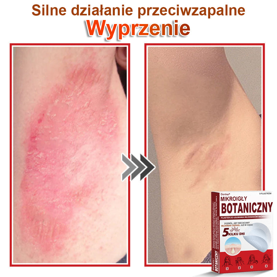 Dorina® Mikroigłowy botaniczny środek do usuwania narośli skórnych ✅✅✅wyprodukowano w Polsce