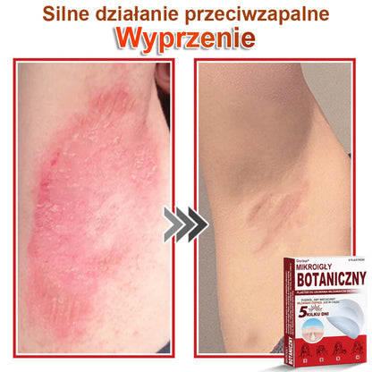 Dorina® Mikroigłowy botaniczny środek do usuwania narośli skórnych ✅✅✅wyprodukowano w Polsce