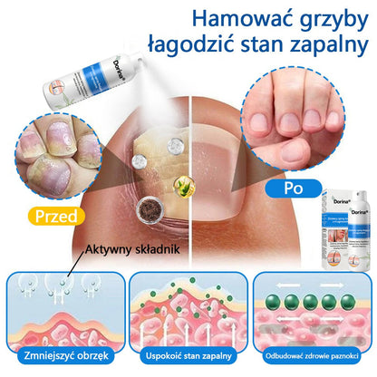 Oficjalny sklep✅: Dorina®Magnezowy spray ziołowy na łuszczycę✨