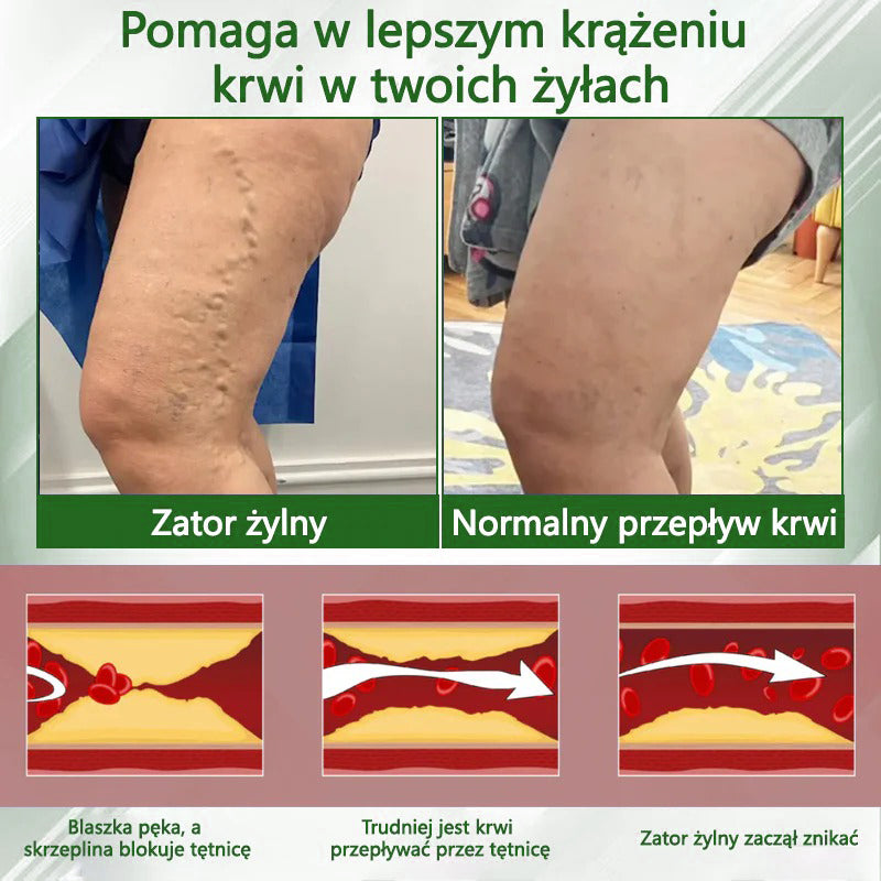 🔥Dorina® Krem ziołowy łagodzący obrzęki z czarnuszką