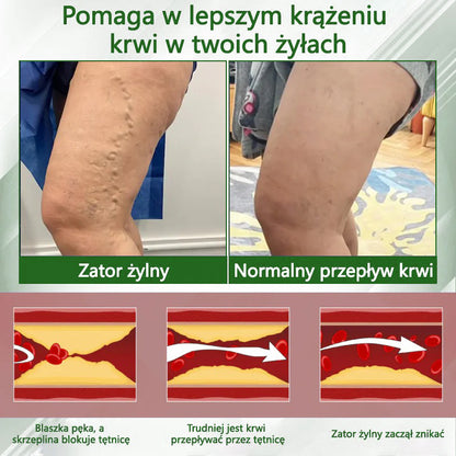 🔥Dorina® Krem ziołowy łagodzący obrzęki z czarnuszką