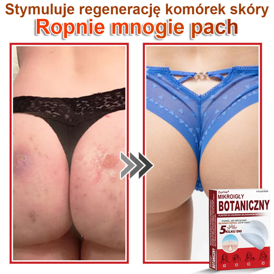 Dorina® Mikroigłowy botaniczny środek do usuwania narośli skórnych ✅✅✅wyprodukowano w Polsce