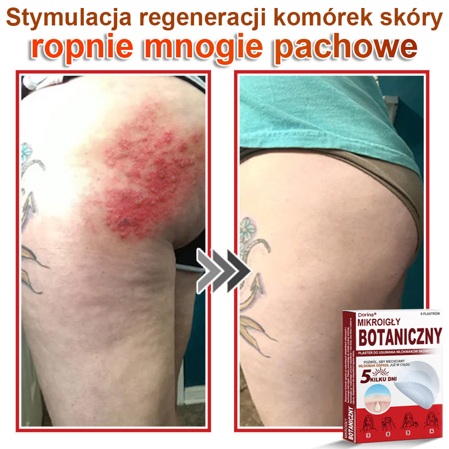 Dorina® Mikroigłowy botaniczny środek do usuwania narośli skórnych ✅✅✅wyprodukowano w Polsce