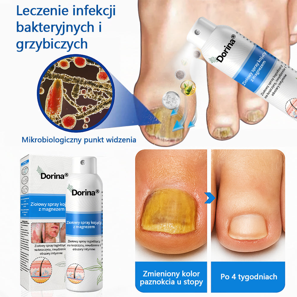 Oficjalny sklep✅: Dorina®Magnezowy spray ziołowy na łuszczycę✨